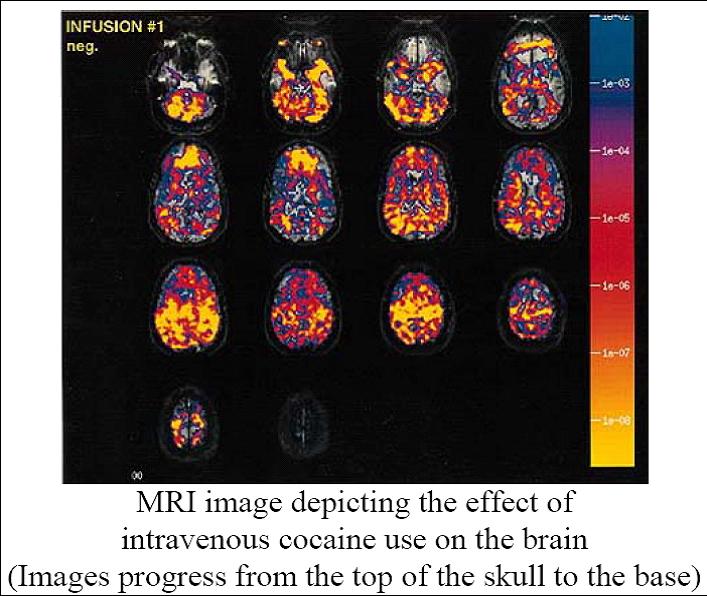 mri brain scan. different MRI scans.
